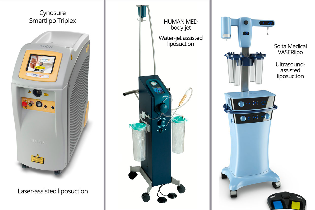 Popular liposuction devices