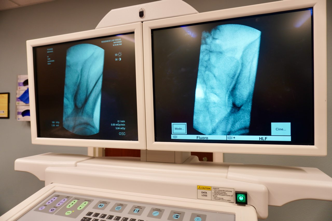SonoSite ultrasound GE fluoroscopy